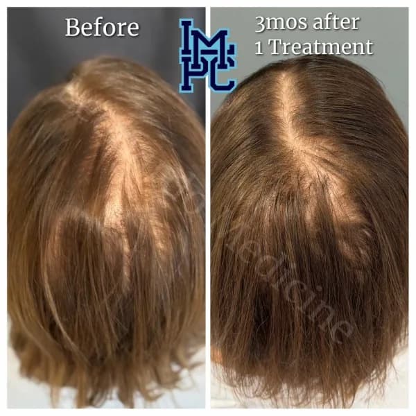 Needleless Hair treatment case 18