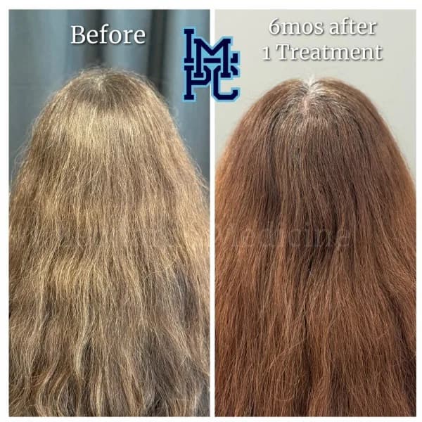 Needleless Hair treatment case 22