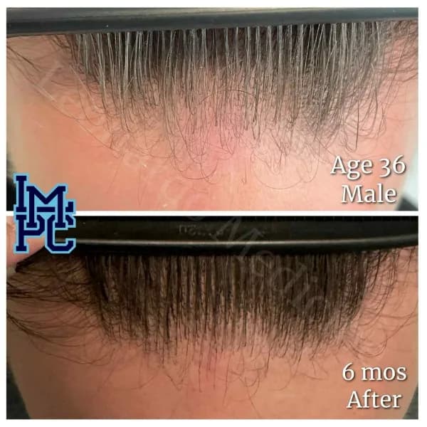 Topical Hair Treatment case 13