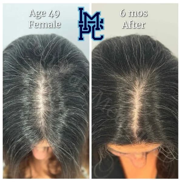 Topical Hair Treatment case 9